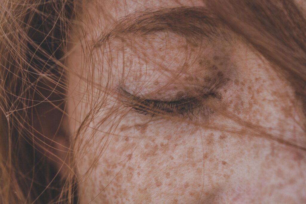 A freckled girl